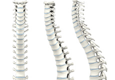 Cervical Spine Surgery