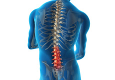 Lumbar Spine Surgery